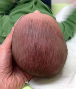 allaitement, ostéopathie, bébé, aide, succion, maman